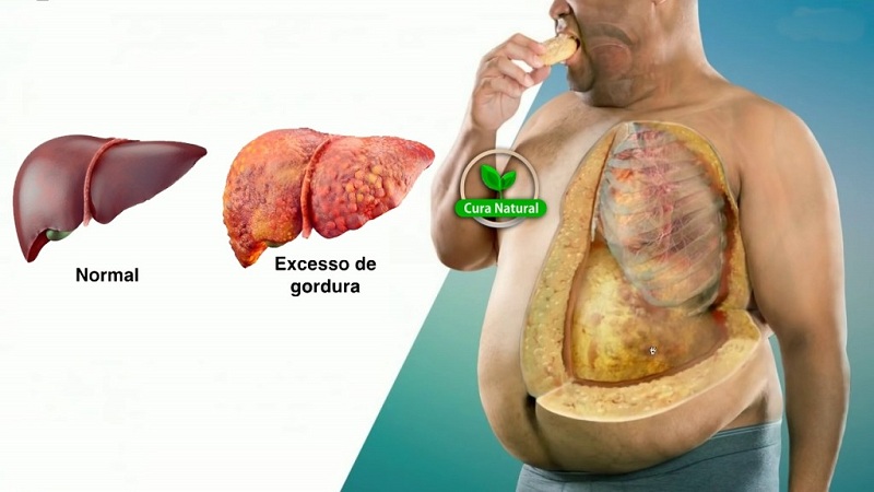 dieta para gordura no fígado